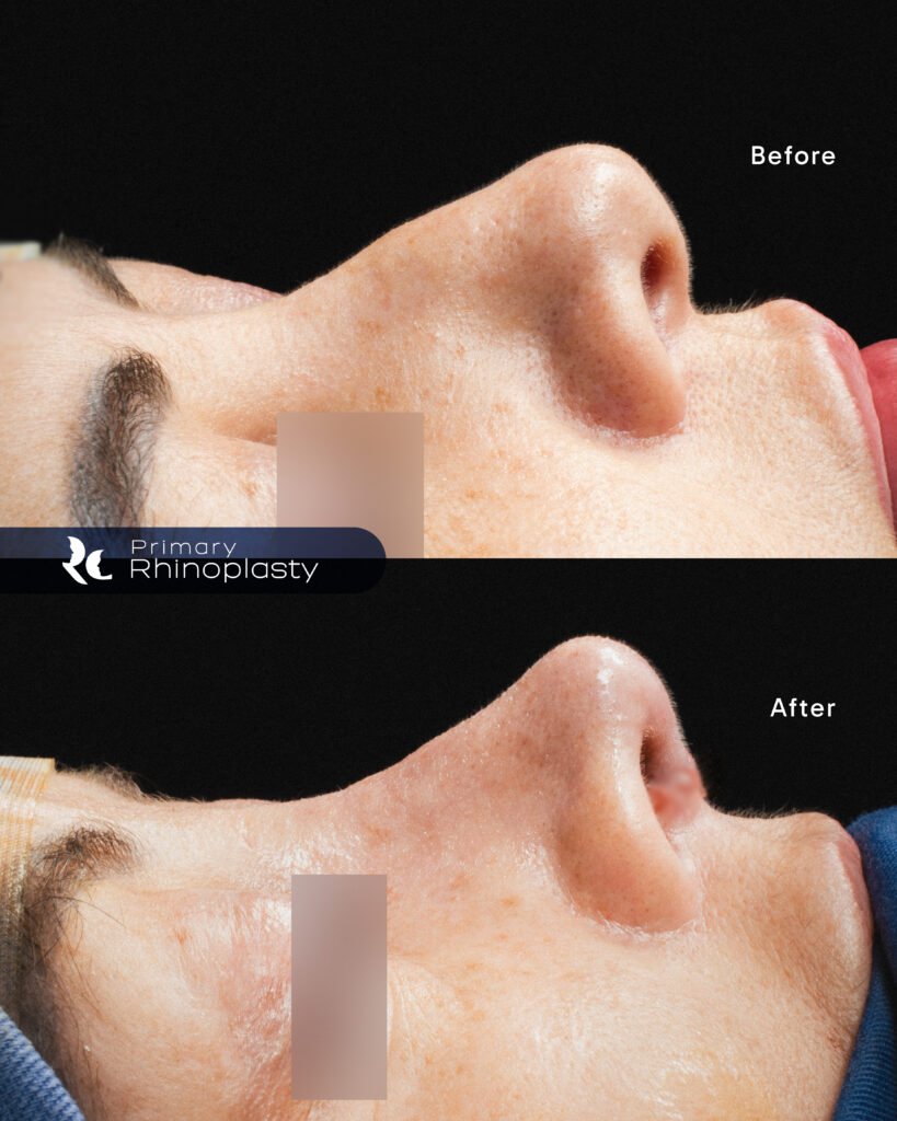 caso cx 15 JUL_Mesa de trabajo 1 copia 3